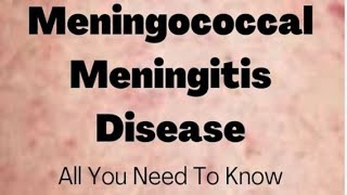 Meningococcal meningitis  social pharmacy 1st year d pharmacy pharmacist biology pharmacy neet [upl. by Inalej107]