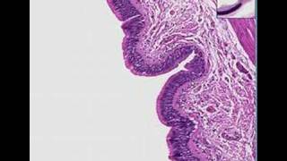 Histopathology Lung bronchus Cryptosporidium [upl. by Llerdnad]