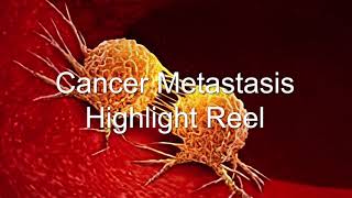 Cancer Metastasis Highlight Reel  Bioxytran BIXT Takes on Cancer [upl. by Nnyleve]