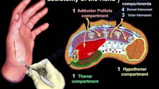 Compartment Syndrome Of The Hand amp Finger  Everything You Need To Know  Dr Nabil Ebraheim [upl. by Virginie]