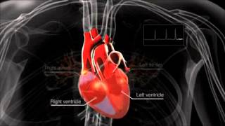 What is atrial fibrillation [upl. by Frederik263]