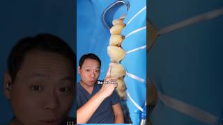 What is Composite Veneers Dentist POV veneers composite smilemakeover njdentist [upl. by Cedell958]