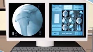 What to Expect during an Arthrogram procedure at RAYUS [upl. by Anilah]