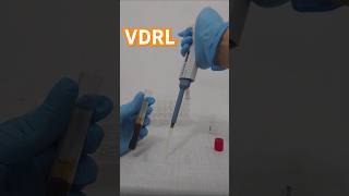 Así se observa una prueba VDRL positiva shorts laboratorioclinico aids [upl. by Shipman]