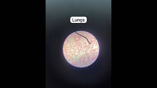 respiratory system histology slides histology medstuber [upl. by Bevus]