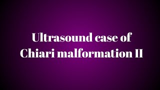 Ultrasound Case Study of Chiari malformation II [upl. by Octavie935]