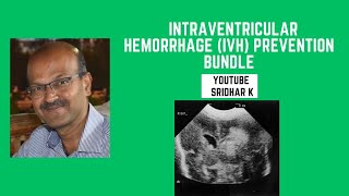 Prevention of IVH Intraventricular hemorrhageIVH prevention bundle IVH IVHprevention carebundle [upl. by Adey691]