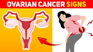 9 Warning Signs of Ovarian Cancer Every Woman Should Know [upl. by Skippie]