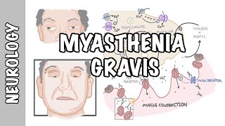 Myasthenia Gravis  symptoms pathophysiology investigations treatment [upl. by Dick]