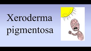 Xeroderma pigmentosum XP [upl. by Niltiak]