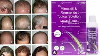 Minfin F10 Topical Solution Minoxidil amp Finasteride Topical Solution [upl. by Roxane]