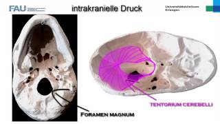 Neurologie ─ Intrakranieller Druck [upl. by Armillia375]