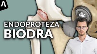 Endoproteza stawu biodrowego I Czy jest KONIECZNA dla Twoich bioder I Fizjomate [upl. by Curcio]