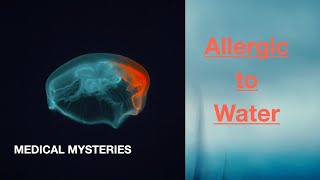 Allergic to Water Medical Mysteries [upl. by Lemyt698]