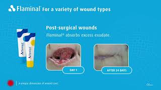 Introducing Flaminal®  effective wound care for acute and chronic wounds [upl. by Hum]