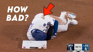 Shohei Ohtani Injures Shoulder in World Series Game 2  Doctor Explain [upl. by Trembly]