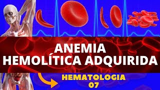 ANEMIA HEMOLÍTICA ADQUIRIDA  HEMATOLOGIA ESTUDO DAS ANEMIAS [upl. by Tekla]