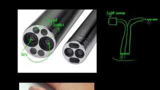 How Does an Endoscope Work  GCSE Physics [upl. by Mendel804]