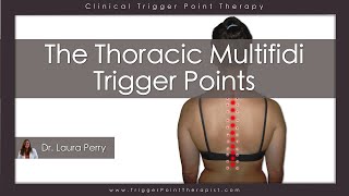 The Thoracic Multifidi Trigger Points [upl. by Nylareg723]