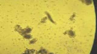 what kind of Paramecium is this [upl. by Alamat]