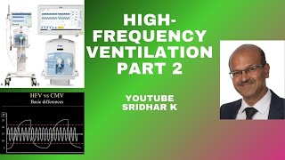 HFOhigh frequency ventilation in neonates part 2neonatalventilation HFOV highfrequency [upl. by Icart]