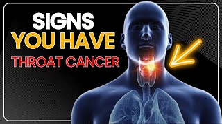 10 Signs You Have Throat Cancer [upl. by Cenac]