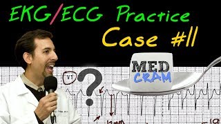 EKG  ECG Interpretation Explained Clearly  Practice Case 11 [upl. by Alekat583]