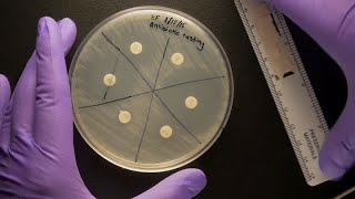 ID Laboratory Videos Antibiotic susceptibility testing [upl. by Danforth81]