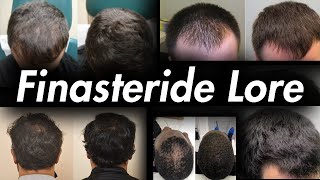 Finasteride Lore Reversing Hair Loss Takes Years Not Months [upl. by Durrett54]