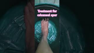 Part ng therapy for calcaneal spur shortvideo feet painrelief footpain sakong sakitsakong [upl. by Yuzik143]