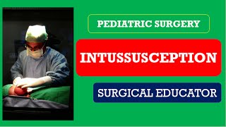 INTUSSUSCEPTION How To DIAGNOSE amp TREAT Pediatric Surgery [upl. by Singer]