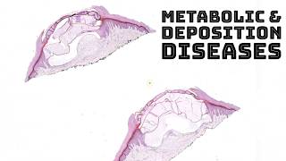 Metabolism amp Deposition Diseases in Skin dermatology dermpath pathology board review [upl. by Einhoj]