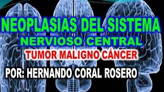 NEOPLASIAS DEL SISTEMA NERVIOSO CENTRAL  TUMOR MALIGNO  CANCER [upl. by Rodoeht]