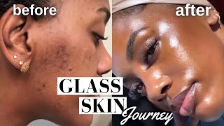 HOW I CLEARED MY HYPERPIGMENTATION ACNE AND DARK SPOTS  GLASS SKIN ROUTINE MUST WATCH [upl. by Lairbag266]