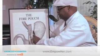 Dr Fobi  The Fobi Pouch How Does It Differ From Standard Gastric Bypass [upl. by Ahseral]