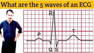 What are the 5 waves of an ECG In Urdu Hindi ECG QRS complex  Explain ECG  EKG Waves Irfan Azeem [upl. by Suoiradal]