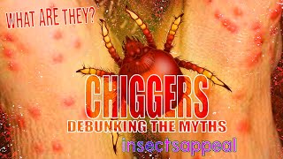 What the HECK is a Chigger  BUG Questions [upl. by Boles122]