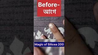 Magic of Silicea 200  ম্যাজিক অফ সিলিসিয়া 200shots youtubeshorts video shortvideo drsmondal [upl. by Scibert]