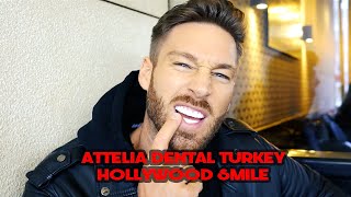 HOLLYWOOD SMILE  ATTELIA DENTAL TURKEY [upl. by Pederson843]