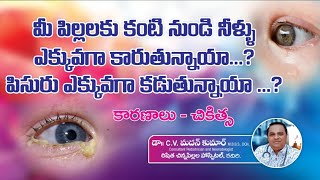 stickyeyes in babies  watery eyes in babies  causes amp treatment  Dr Madan Kumar cv [upl. by Ecinereb]