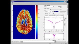 CEST MRI data evaluation tool part 22  Lorentzian fitting [upl. by Chauncey]