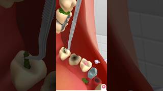 teeth cleaning by animation animation treatment kidsvideo satisfying relax [upl. by Hainahpez847]