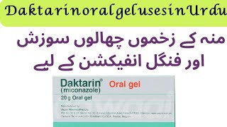 Daktarin oral gel uses  how to use daktarin oral gel  miconazole [upl. by Alleyne]