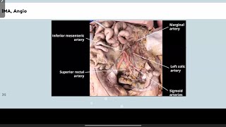 MASTERING ANGIOGRAMS FOR FRCR1PART 3 [upl. by Yerffe]