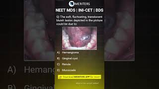 NEET MDS  INICET MDS  PSC  BDS  Most Important Questions neetmds2025 mdsprep [upl. by Angelica]