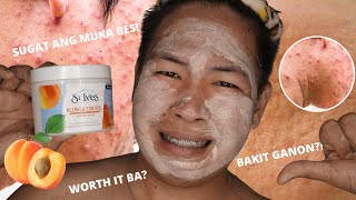 ST IVES BLEMISH CONTROL APRICOT SCRUB HONEST REVIEW PHILIPPINES [upl. by Asirahc]