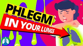 Top 10 Ways to Get Rid of Constant Mucus and Phlegm in Your Throat [upl. by Fernandes76]