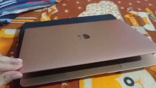 macbook air m1 battery Problem  macbook air m1 Amazon  Replacement warranty  WATCH THIS BEFORE [upl. by Gabbi]