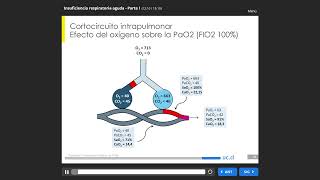018 Insuficiencia Respiratoria Aguda [upl. by Jeannine901]