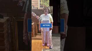 Incredible Transformation with Gastric Sleeve Surgery in Tijuana Mexico Tracys Before amp After [upl. by Odelle]